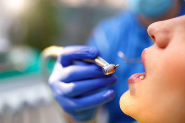 Best Teeth Whitening  in Lambert, MS